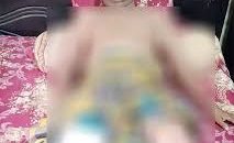 রিকশাচালককে পিটিয়ে পা ভেঙে দেয়ার অভিযোগ