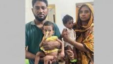 দশ ঘণ্টার অস্ত্রোপচারে আলাদা জীবনে রিফা ও শিফা