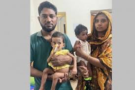 দশ ঘণ্টার অস্ত্রোপচারে আলাদা জীবনে রিফা ও শিফা