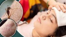 গত ২৪ ঘণ্টায় ডেঙ্গুতে আরও ৩ মৃত্যু, নতুন আক্রান্ত ৮২৯