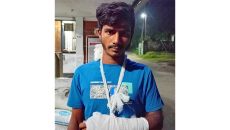 মাগুরায় হাতুড়ি দিয়ে যুবকের হাত ভেঙে দিলো দুর্বৃত্তরা