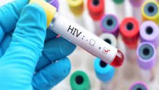 এইচআইভি আক্রান্ত শতাধিক প্রবাসীদের নিজ দেশে পাঠাচ্ছে কুয়েত