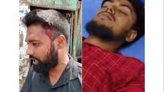 মেট্রোরেলের চোরাই মালামাল ও মাদকচক্রের অনুসন্ধানে গিয়ে হামলার শিকার সাংবাদিকরা, থানায় মামলা