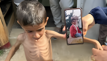 পরবর্তী ৪৮ ঘণ্টায় গাজায় মারা যেতে পারে ১৪,০০০ শিশু