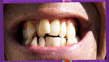 নরম খাবারেই বদলে গেছে আমাদের চেহারা?