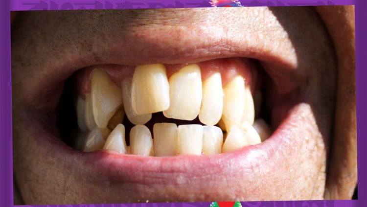 নরম খাবারেই বদলে গেছে আমাদের চেহারা?