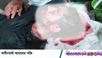 বাবুগঞ্জে মাদকবিরোধী অভিযানে কনস্টেবলসহ আহত ৩