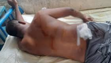 রাজবাড়ীতে চাঁদা না দেওয়ায় প্যানেল চেয়ারম্যানকে কুপিয়ে জখম