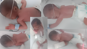 একসঙ্গে ৫ সন্তানের জন্ম দিলেন পাকিস্তানি নারী