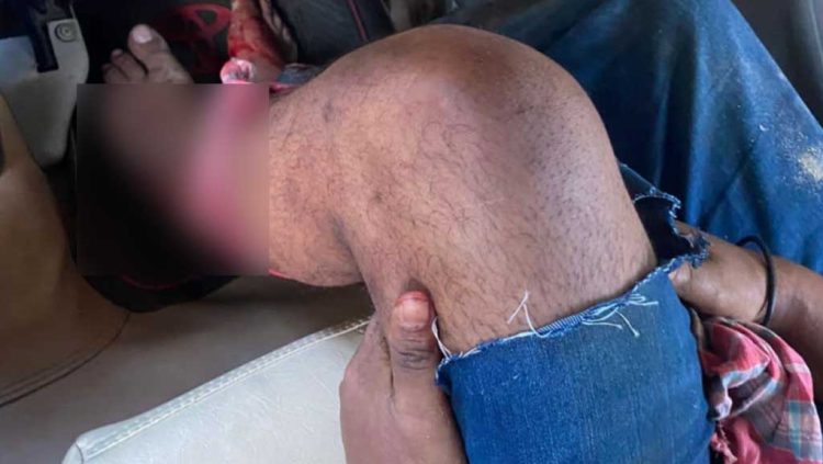 পল্লবীতে চাঁদা না পেয়ে আবাসন কোম্পানিতে হামলা ও গুলি, গ্রেপ্তার ৩