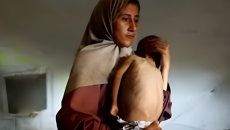 গাজায় অপুষ্টি-অনাহারে আরও শতাধিক শিশুর মৃত্যু