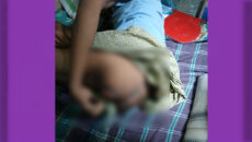 বিদ্যুৎস্পৃষ্ট হয়ে পঙ্গুত্ব—চিকিৎসার অভাবে নিঃস্ব জলফু মিয়া