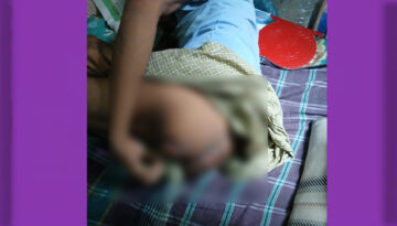 বিদ্যুৎস্পৃষ্ট হয়ে পঙ্গুত্ব—চিকিৎসার অভাবে নিঃস্ব জলফু মিয়া