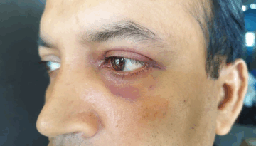 আমতলীতে স্কুল শিক্ষক অপহরণ ও বর্বর নির্যাতন