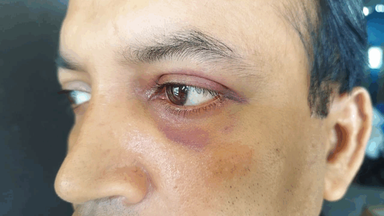 আমতলীতে স্কুল শিক্ষক অপহরণ ও বর্বর নির্যাতন