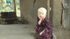 ফর্সা ত্বকেই জন্মে বঞ্চনা, যশোরের আফিয়া ও তার মায়ের কষ্ট