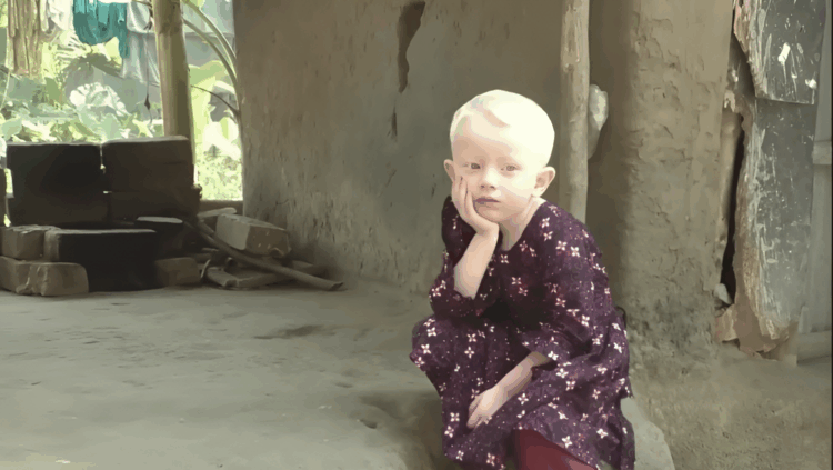 ফর্সা ত্বকেই জন্মে বঞ্চনা, যশোরের আফিয়া ও তার মায়ের কষ্ট